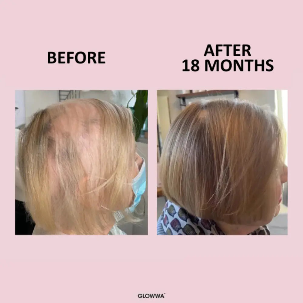 GLOWWA Hair Food