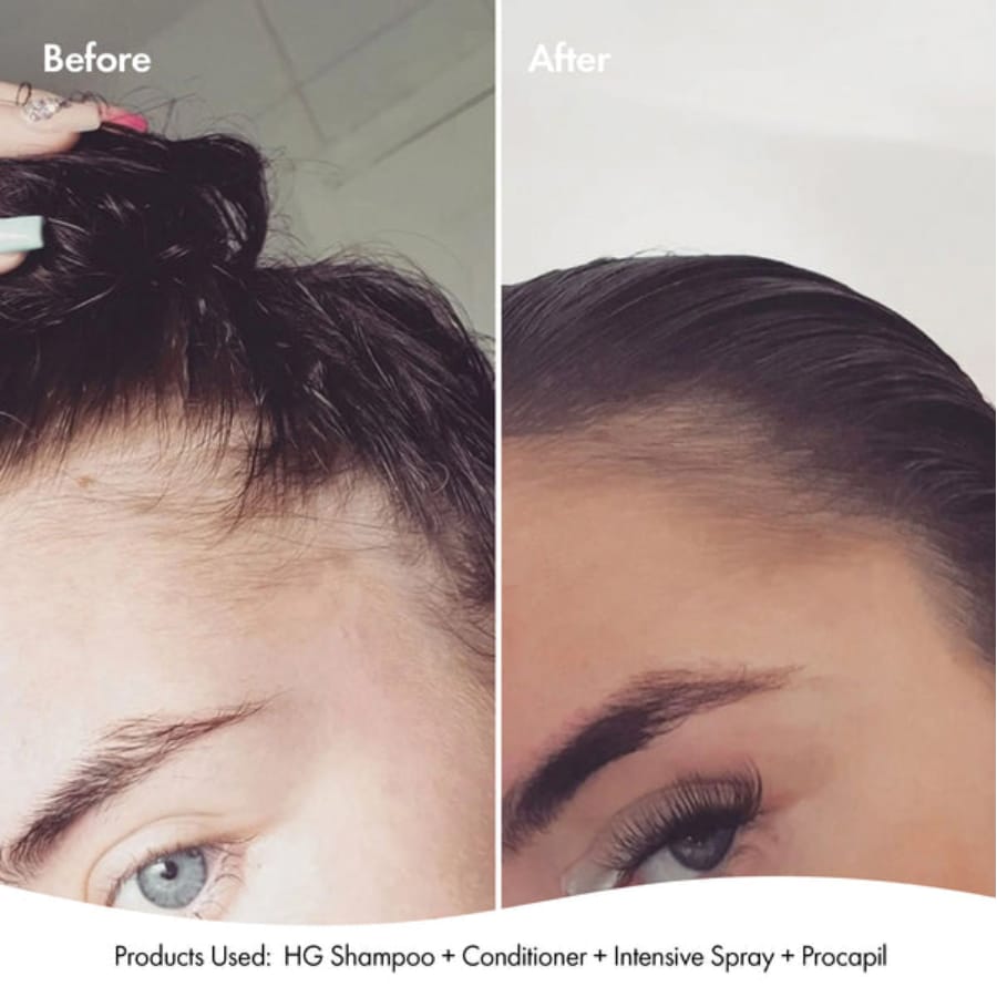 Bondi Boost Anti-Thinning Intensive Scalp Spray