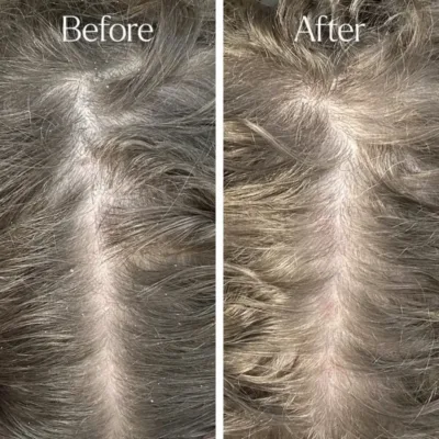 Only Curls Detox Clarifying Shampoo